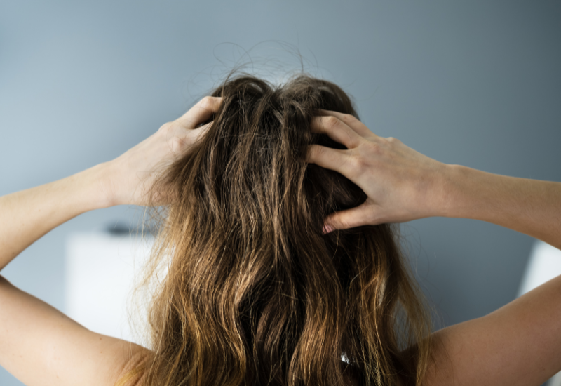 Rụng tóc gây ảnh hưởng nhiều đến sức khỏe và chất lượng cuộc sống